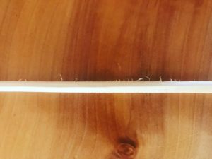 ギプスを取った脚イメージ